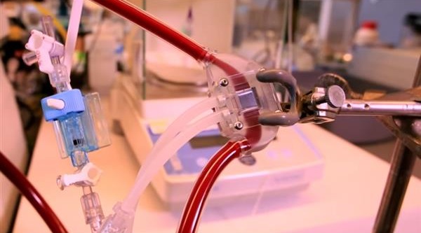 科學家使用3D打印技術開發人工腎臟 科學家使用3D打印技術開發人工腎臟