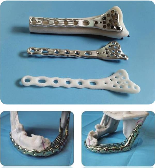 乫˾ʹSHS 3DӡCtֲԭ