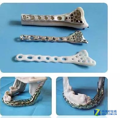 TCTչ3DӡڹǰOӋеđ 