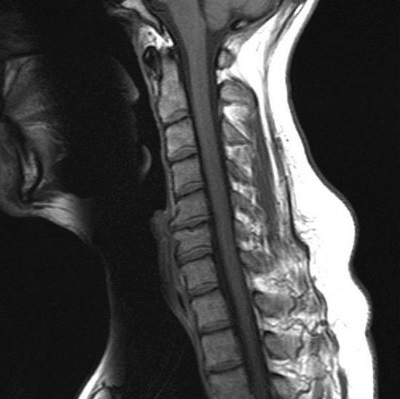 Stryker˾3Dӡ⁽ٺ·׵gP@FDA