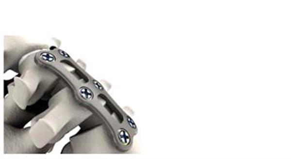 Stryker˾3Dӡ⁽ٺ·׵gP@FDA