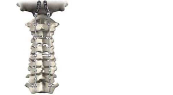 Stryker˾3Dӡ⁽ٺ·׵gP@FDA