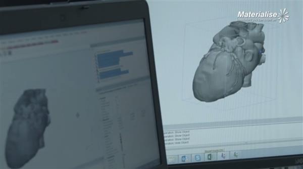 Materialise CEOP(gun)ע3Dӡt(y)I(y)