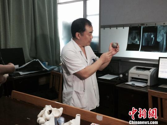 江西省人民醫院骨二科主任董謝平介紹3D打印技術。 吳鵬泉 攝 江西省人民醫院骨二科主任董謝平介紹3D打印技術。 吳鵬泉 攝