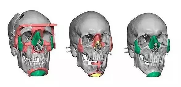 աt(y)3DӡϴPc(din)