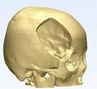 <b>t(y)ԺB沿3DӡwÓQg(sh)</b>