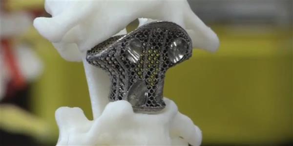 2016年3D打印醫療器械市場 2.8億美元