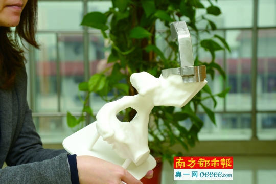 3D打印 成為骨科醫生“超級幫手”