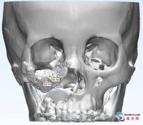 <b>ݳɹ(sh)ʩ3Dӡޏ(f)g(sh)</b>