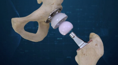 __(d)t(y)ʹCONFORMIS 3DӡֲM(jn)yP(gun)(ji)ÓQ