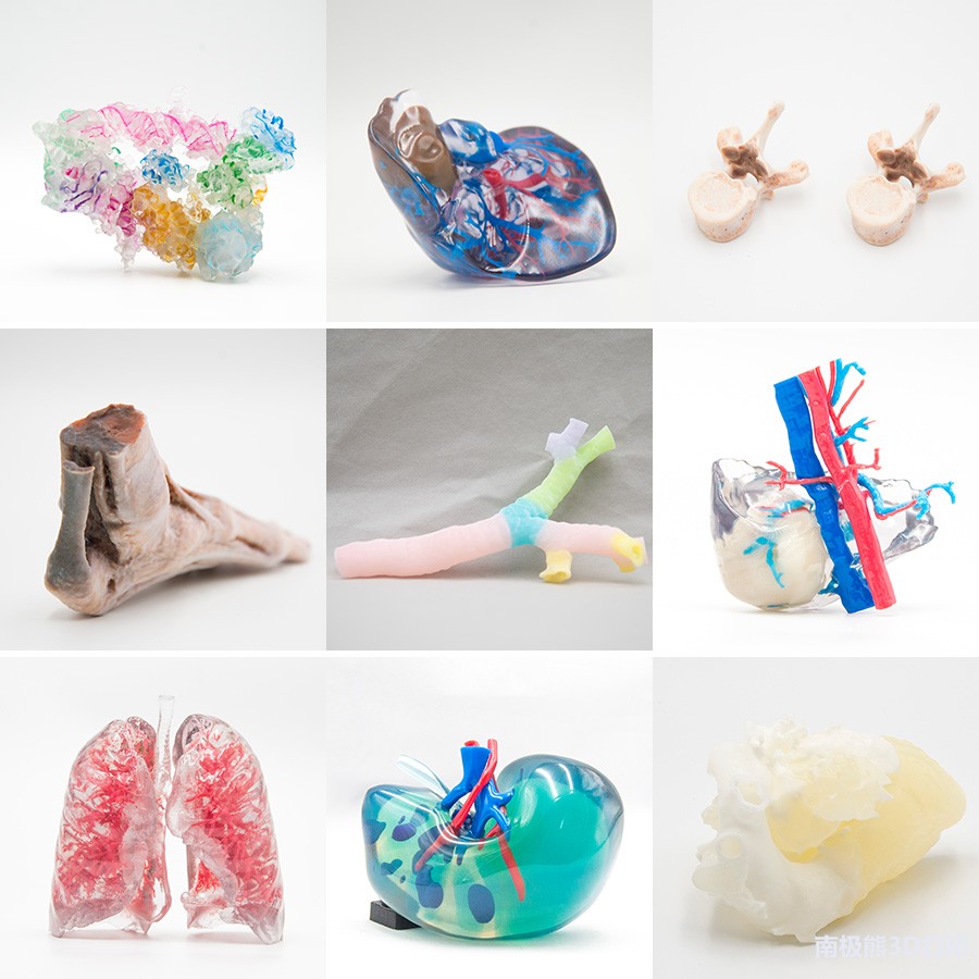 實例: 3D打印血管模型 實例: 3D打印血管模型