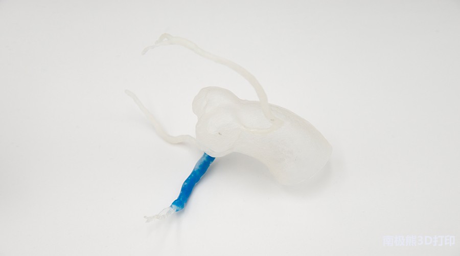 實例: 3D打印血管模型 實例: 3D打印血管模型