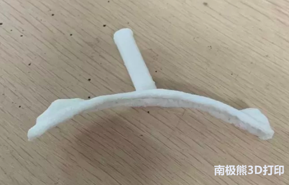 3D-slicer輔助3D打印導(dǎo)板技術(shù)及其臨床運(yùn)用 3D-slicer輔助3D打印導(dǎo)板技術(shù)及其臨床運(yùn)用