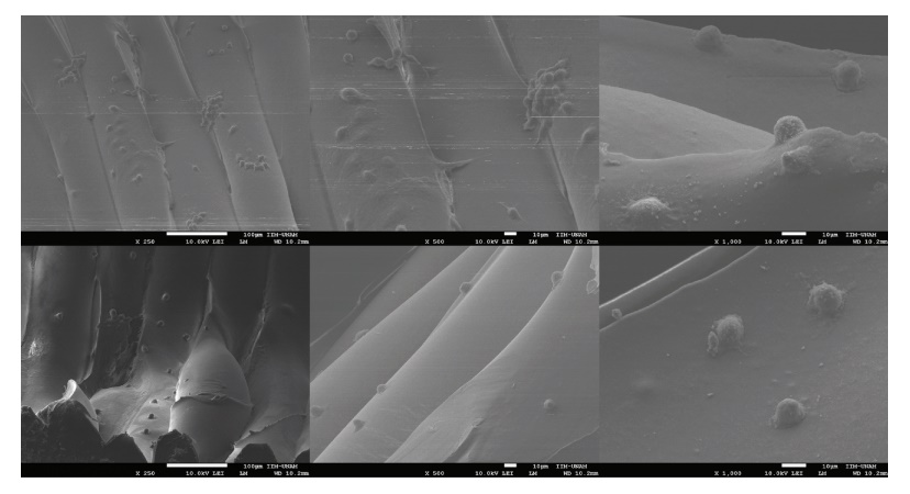 用hFOB細(xì)胞接種的3D管狀支架表面的SEM顯微照片顯示一些具有成骨細(xì)胞典型的橢圓形至紡錘形形態(tài)的細(xì)胞 用hFOB細(xì)胞接種的3D管狀支架表面的SEM顯微照片顯示一些具有成骨細(xì)胞典型的橢圓形至紡錘形形態(tài)的細(xì)胞