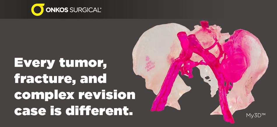 Onkos Surgical My3D™個性化解決方案平臺 Onkos Surgical My3D™個性化解決方案平臺