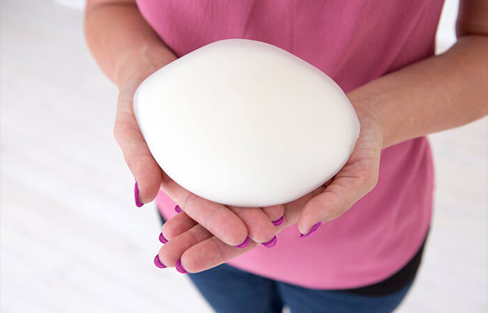 使用3D打印模具制作的定制乳房假體 使用3D打印模具制作的定制乳房假體