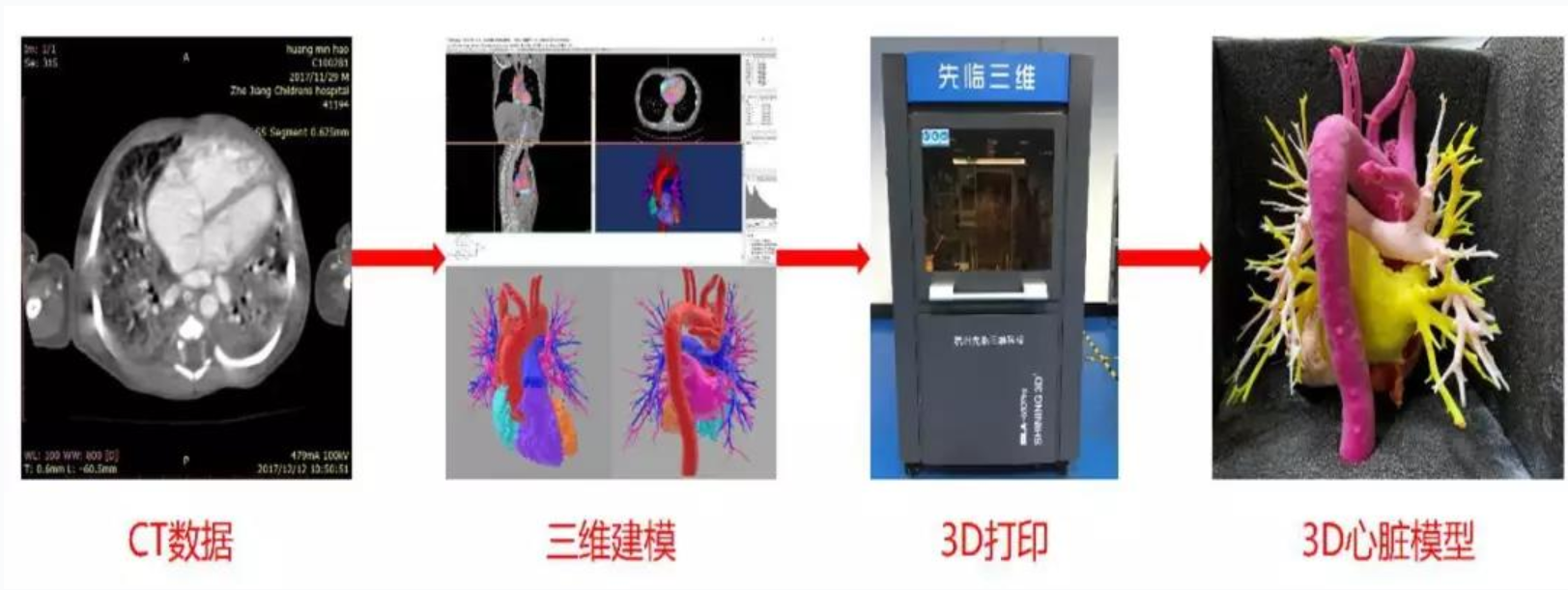個(gè)體化心臟模型的3D打印過程 個(gè)體化心臟模型的3D打印過程