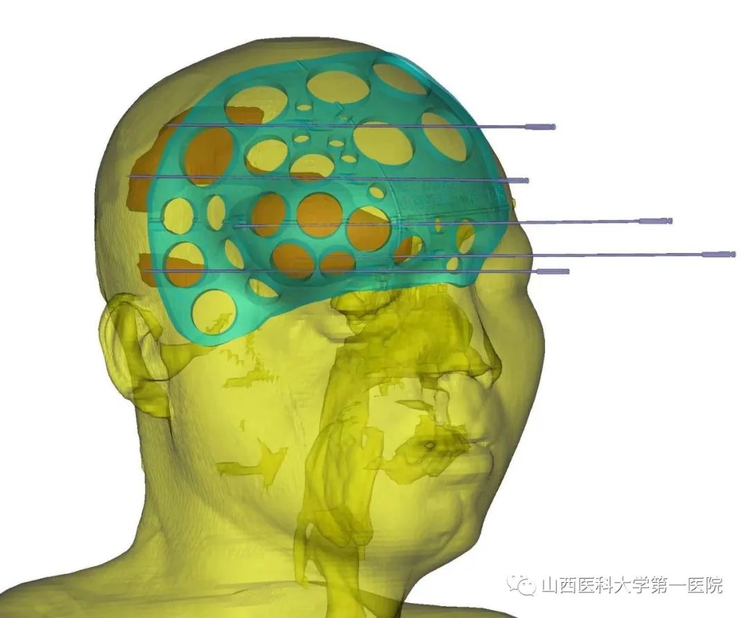 3DӡǹģµĲֲů^iͰl[