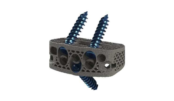 DeGen Medical 3Dӡ׵gںи߿ҕԺ͙C(j)е