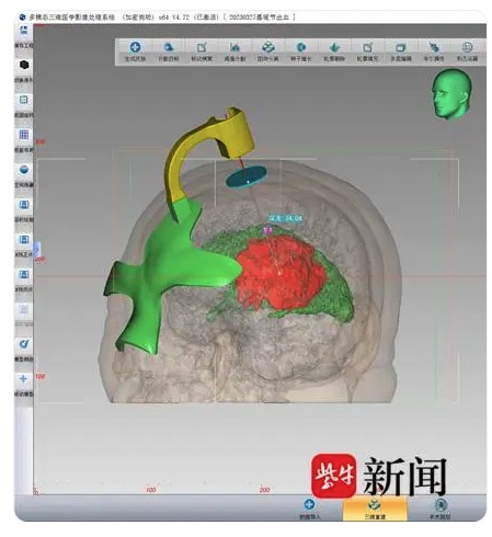 3Dӡg(sh)׌Xt(y)(zhn)(dng)