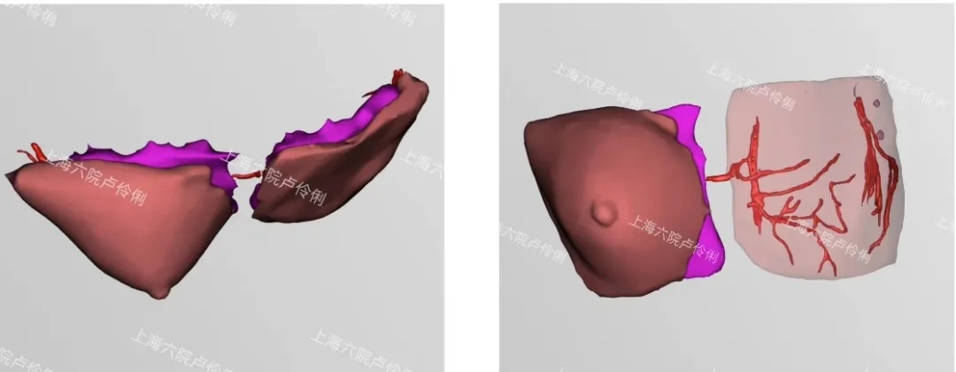 ϺеtԺ3Dӡ1:1鷿ٰg